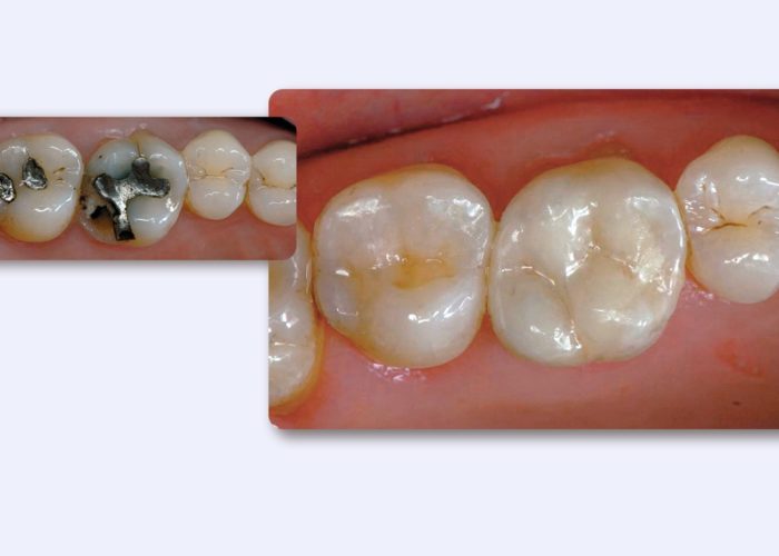 Dentistry by Dr St phane Cazier, France